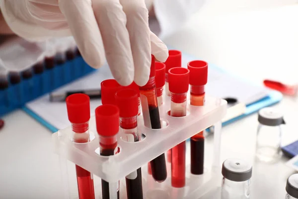 Woman Working Blood Samples Laboratory Closeup — Stock Photo, Image