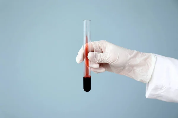 Laboratóriumi Asszisztens Gazdaság Kémcsőben Vért Háttér Színét Kézzel — Stock Fotó