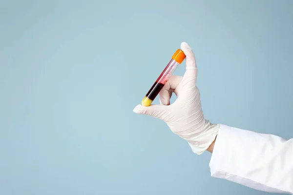 Laboratuar Asistanı Holding Tüp Kan Örneği Renk Arka Plan Üzerinde — Stok fotoğraf