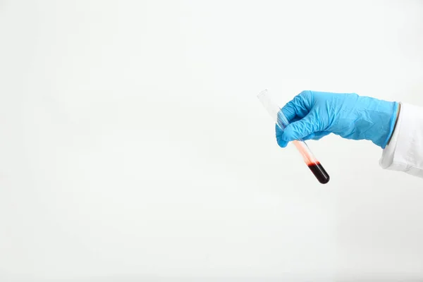 实验室助理手拿试管与血液样品在白色背景 — 图库照片