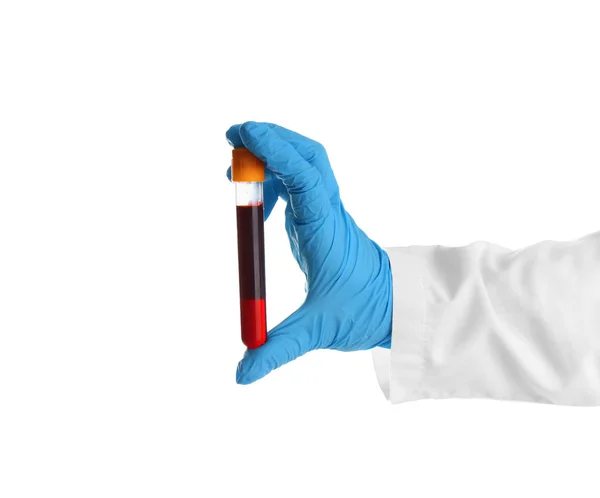 白い背景の上の血液サンプルを研究室アシスタント保持テスト チューブの手 — ストック写真