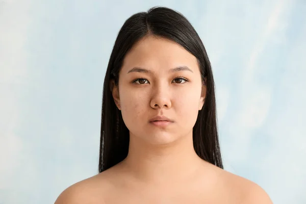 Portrait of young Asian woman with acne problem on color background