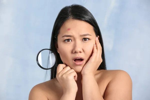 Portrait of shocked Asian woman with acne problem and magnifier on color background