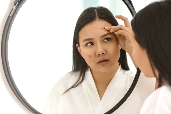 Retrato Mujer Asiática Joven Con Problemas Acné Mirando Espejo — Foto de Stock