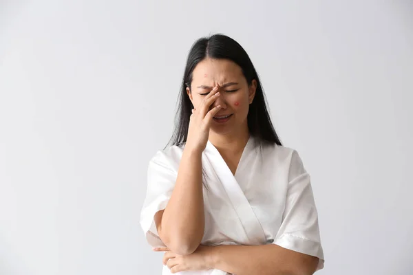 Portrait Sad Young Asian Woman Acne Problem White Background — Stock Photo, Image