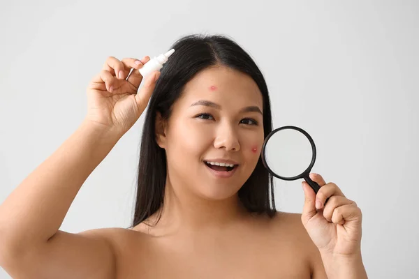 Portrait Young Asian Woman Remedy Acne Magnifier White Background — Stock Photo, Image