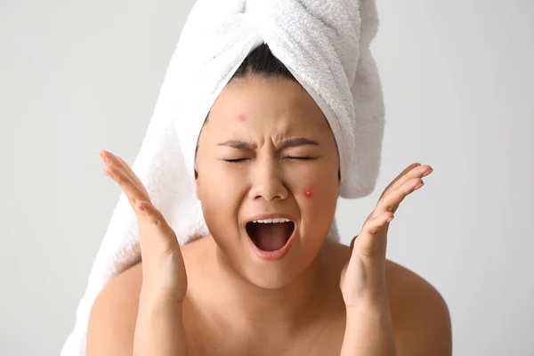 Portrait Stressed Asian Woman Acne Problem White Background — Stock fotografie