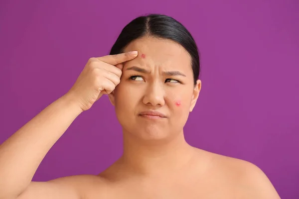 Retrato Mujer Asiática Joven Con Problema Acné Fondo Color — Foto de Stock