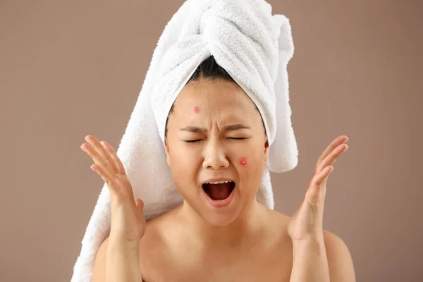 在颜色背景上有粉刺问题的亚洲压力妇女的肖像 — 图库照片