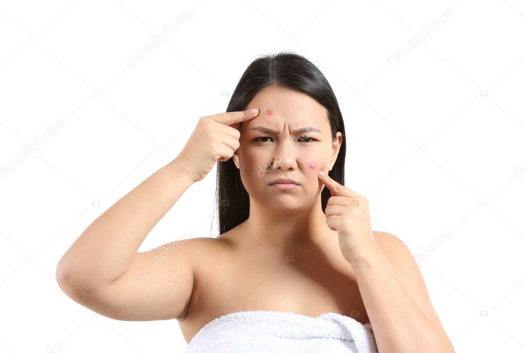 Portrait of young Asian woman with acne problem on white background