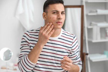 Akne problemi evde olan genç adam portresi