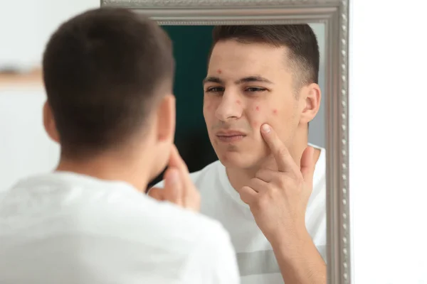 Retrato Homem Jovem Com Problema Acne Olhando Espelho Casa — Fotografia de Stock