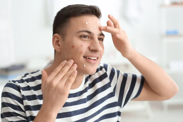 Portret Van Jonge Man Met Remedie Tegen Acne Thuis — Stockfoto