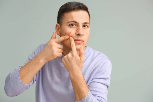 Retrato Joven Con Problemas Acné Aplastando Espinillas Sobre Fondo Gris —  Fotos de Stock