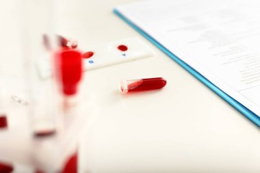 Kan örnekleri laboratuvar tablo