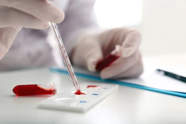 Mujer Trabajando Con Muestra Sangre Laboratorio Primer Plano — Foto de Stock