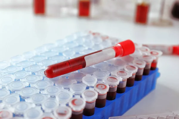 Tubos de ensayo con muestras de sangre en el soporte, primer plano — Foto de Stock