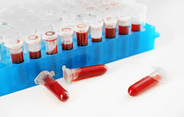 Test tubes with blood on table — Stock Photo, Image