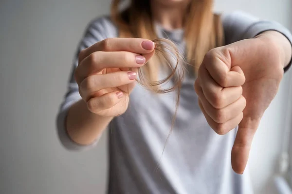 Woman with hair loss problem showing thumb-down on grey background — Stock Photo, Image