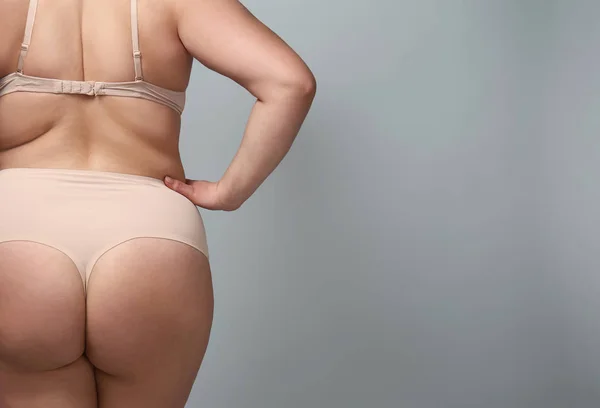 Vrouw met overgewicht op grijze achtergrond — Stockfoto