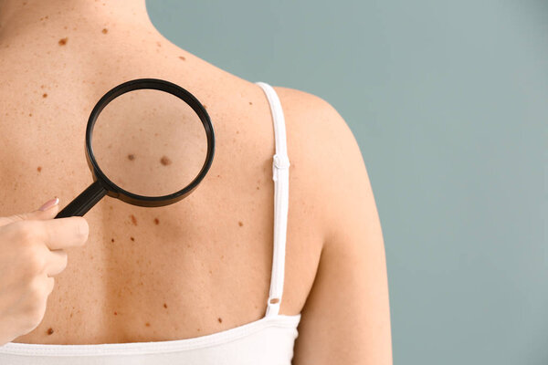 Dermatologist examining moles of patient on grey background