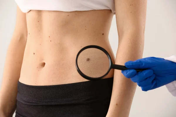 Dermatólogo examinando lunares del paciente sobre fondo claro — Foto de Stock