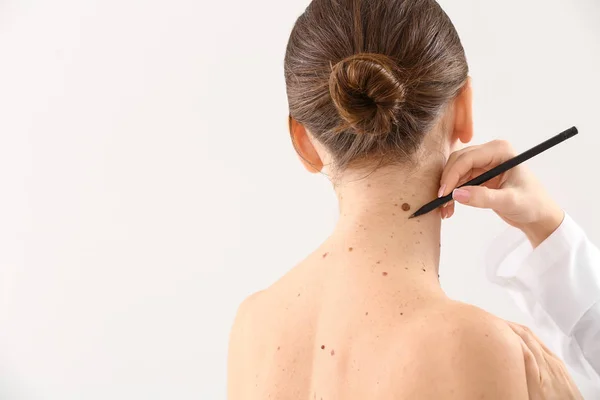 Dermatologist applying marks onto patient's skin before moles removal against light background — Stock Photo, Image