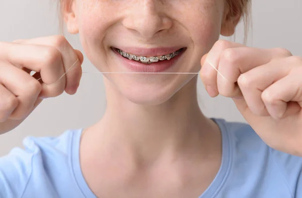 Sonriente adolescente con frenos dentales sosteniendo hilo dental sobre fondo gris, primer plano —  Fotos de Stock