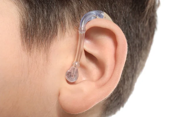 Little boy with hearing aid, closeup — Stock Photo, Image