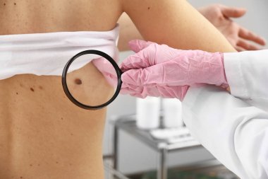 Klinikte hastanın benleri muayene dermatolog, çekim