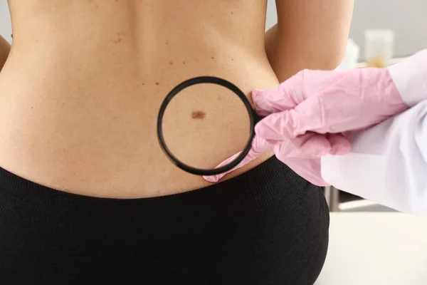 Dermatologist examining moles of patient in clinic — Stock Photo, Image