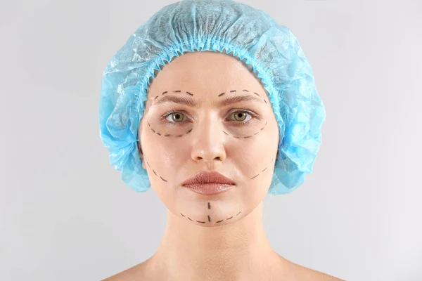 Jonge vrouw met littekens op haar gezicht tegen een lichte achtergrond. Concept van plastische chirurgie — Stockfoto