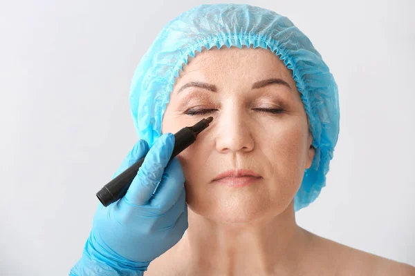 Plastic surgeon applying marking on female face against light background — Stock Photo, Image