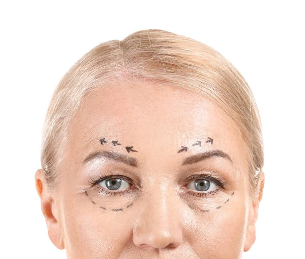 Rijpe vrouw met vlekken op haar gezicht tegen witte achtergrond, close-up. Concept van plastische chirurgie — Stockfoto