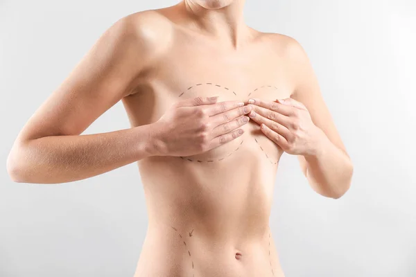 Naked woman with marks on her chest against light background. Concept of breast augmentation — Stock Photo, Image