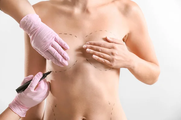 Doctor drawing marks on female breast before cosmetic surgery operation against light background — Stock Photo, Image
