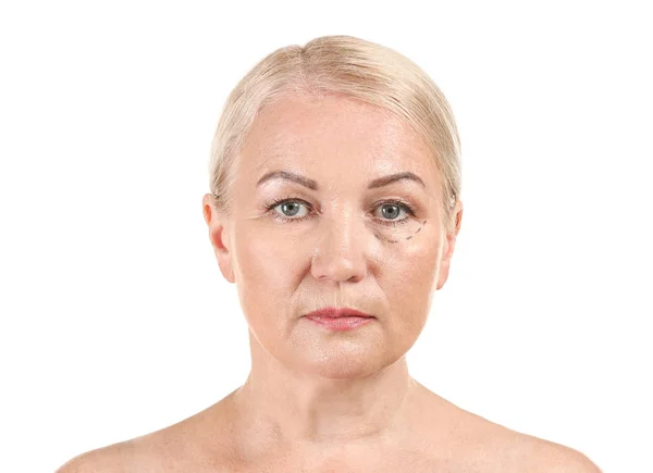 Mujer madura con marcas en la cara sobre fondo blanco. Concepto de cirugía plástica —  Fotos de Stock
