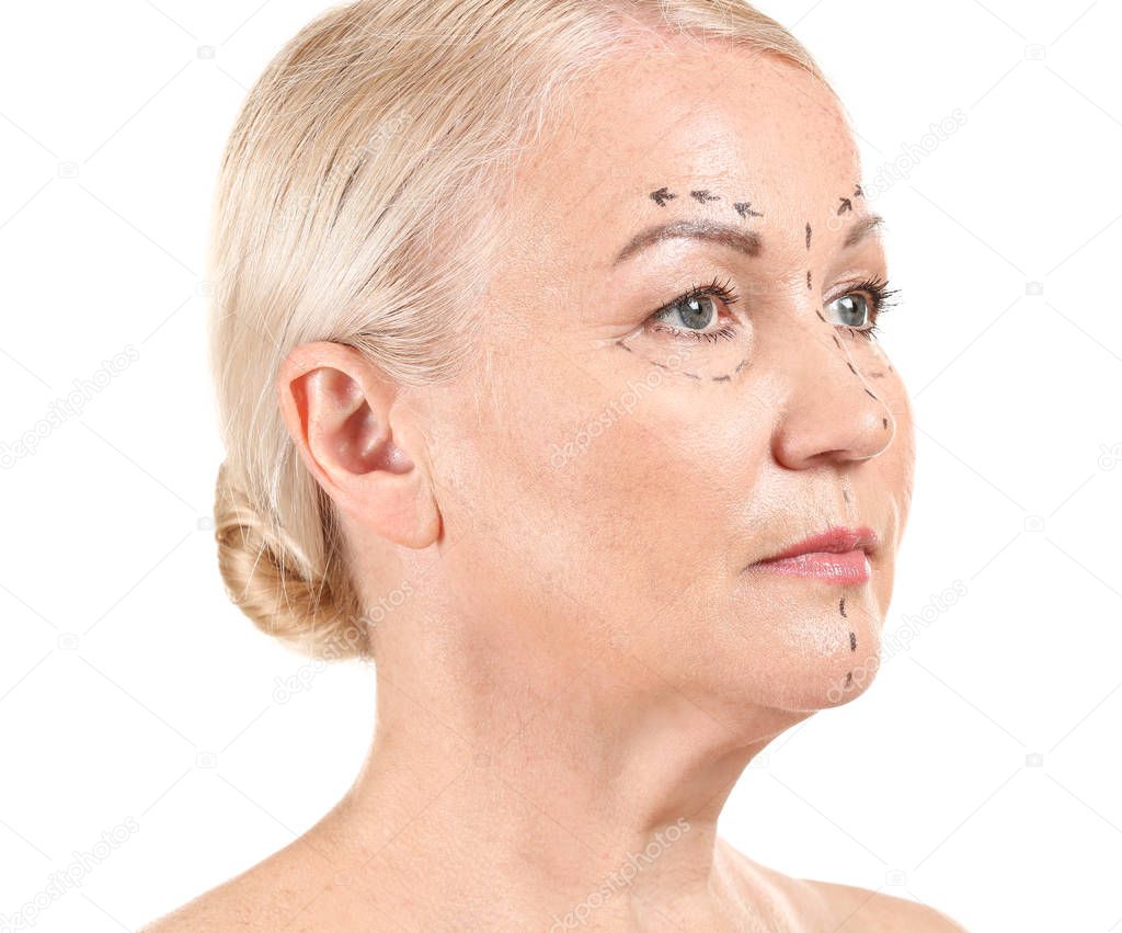 Mature woman with marks on her face against white background. Concept of plastic surgery