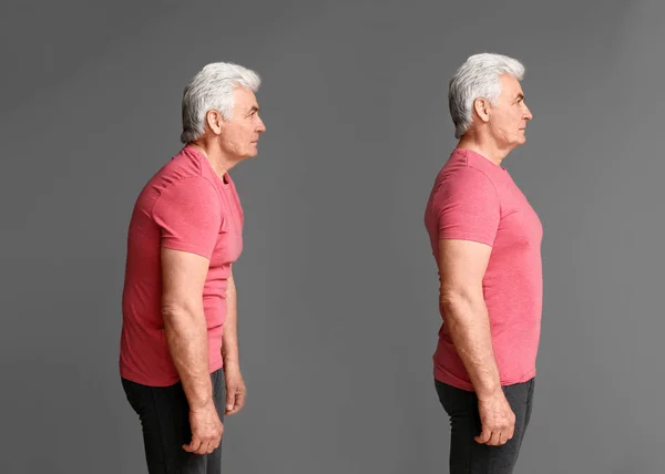 Mature man with poor and good posture on grey background — Stock Image Mature man with poor and good posture on grey background Royalty Free Stock Photos