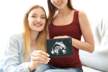 Evde sonogram görüntü ile hamile lezbiyen çift