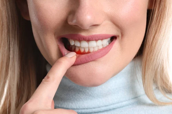 Woman with gum inflammation, closeup — Stock Photo, Image