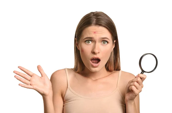 Portrait de jeune femme stressée avec problème d'acné et loupe sur fond blanc — Photo