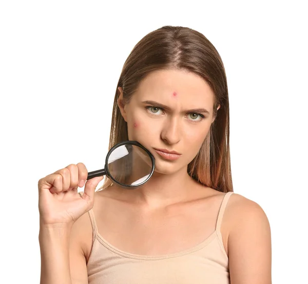 Portrait of young woman with acne problem and magnifier on white background — Stock Photo, Image