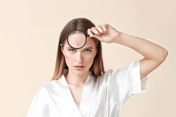 Portret van jonge vrouw met acne probleem en vergrootglas op lichte achtergrond — Stockfoto