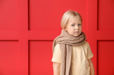 Renk arka planda suçiçeği ile küçük kız hasta