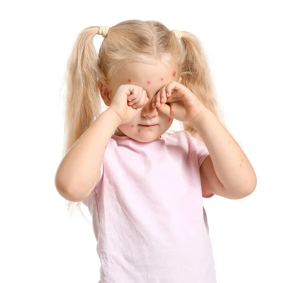 Μικρό κορίτσι άρρωστο με ανεμοβλογιά σε λευκό φόντο — Φωτογραφία Αρχείου