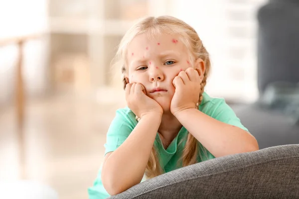 Niña enferma de varicela en casa — Foto de Stock