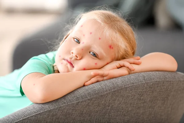 Niña enferma de varicela en casa — Foto de Stock