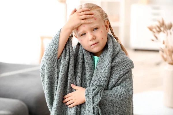 Niña enferma de varicela en casa — Foto de Stock