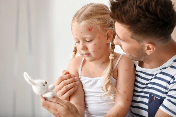 Hombre cuidando a su pequeña hija enferma de varicela en casa — Foto de Stock